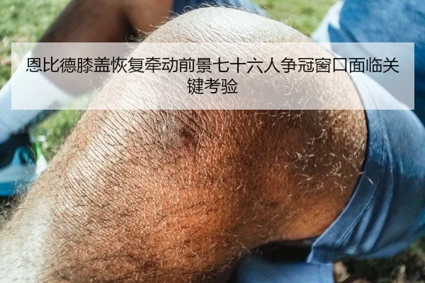 恩比德膝盖恢复牵动前景七十六人争冠窗口面临关键考验